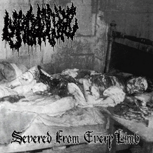 Severed from Every Limb
